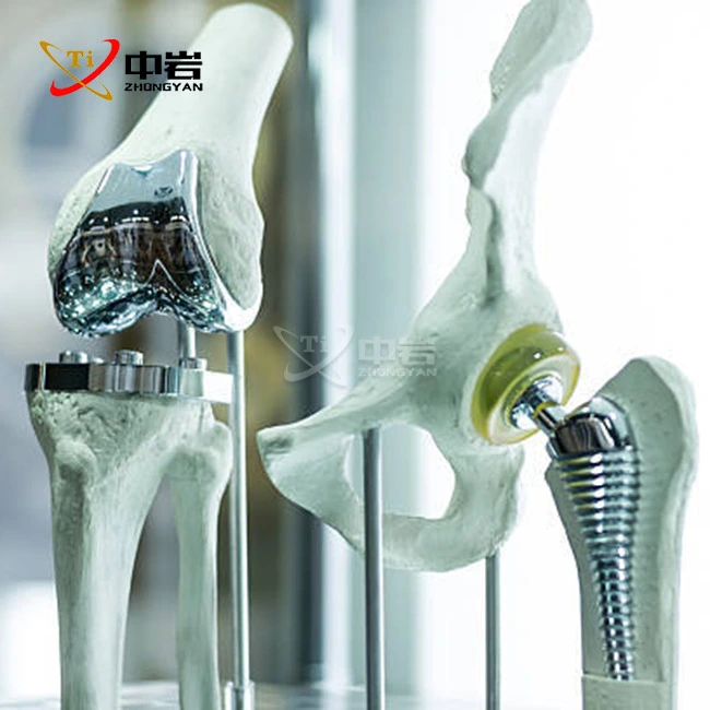 medical titanium rod