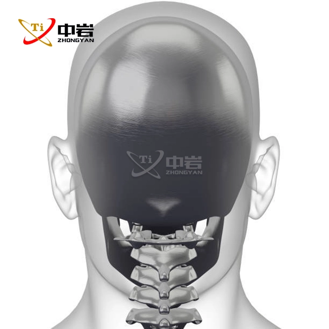 titanium skull plate