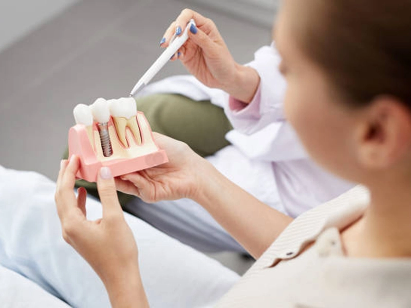 Dental implant procedures